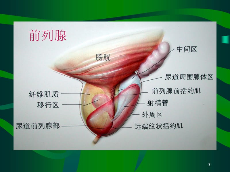 PVP手术护理配合ppt课件_第3页