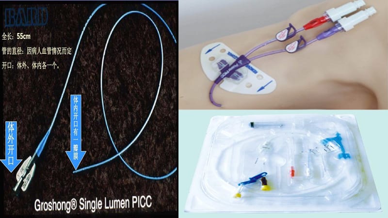 PICC导管的置管与护理ppt课件_第3页