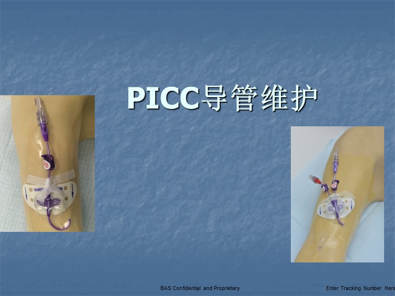 PICC导管维护更新ppt课件_第1页