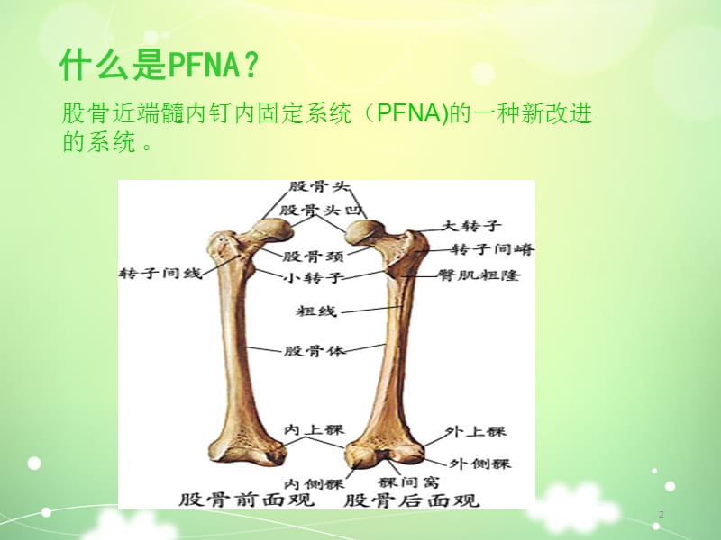 PFNA髓内钉手术配合ppt课件_第2页