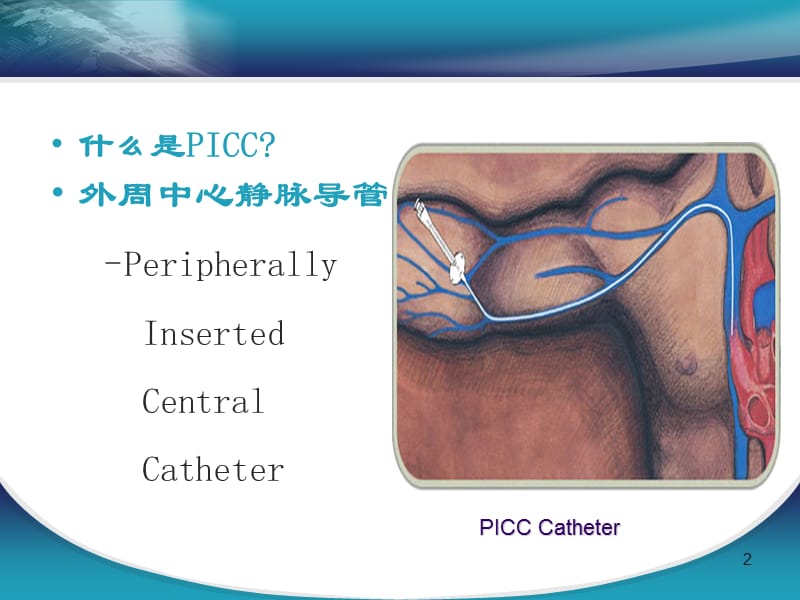 PICC维护过程中出现的并发症预防及护理ppt课件_第2页