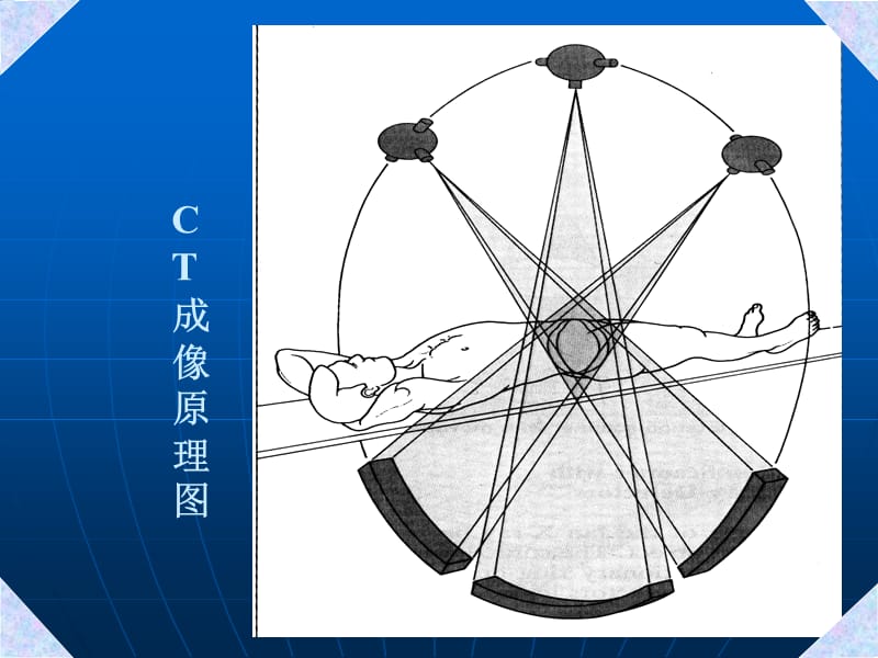 CT成像技术及临床应用ppt课件_第3页