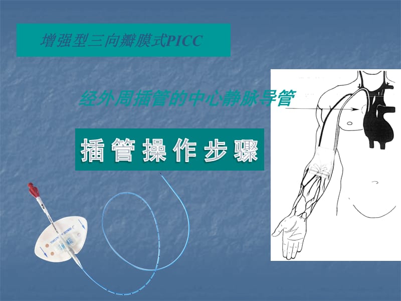 PICC操作及维护ppt课件_第1页