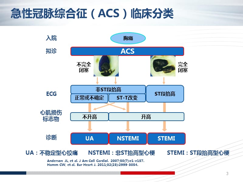 NSTE-ACS诊断标准和治疗原则解读ppt课件_第3页