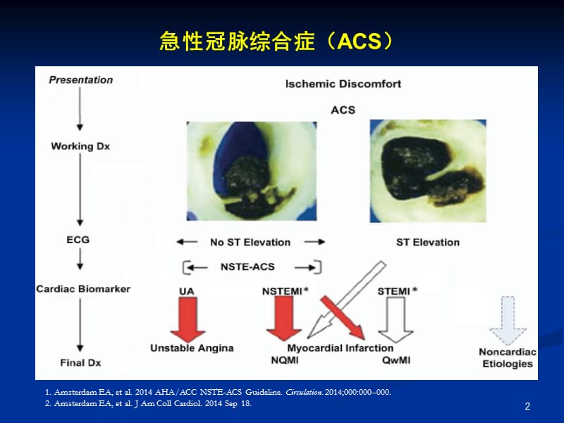 NSTEMI-ACS危险分层与规范化诊疗ppt课件_第2页