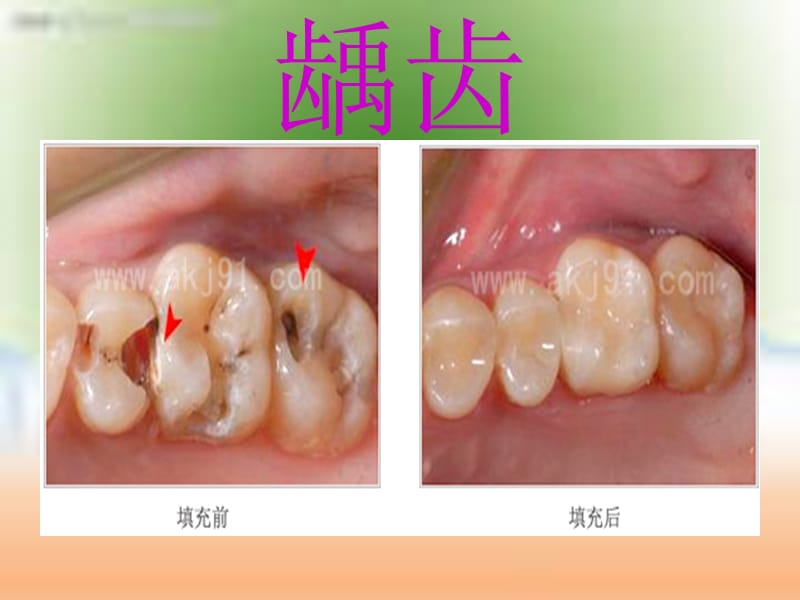 如何做好中小学生的口腔保健_第2页