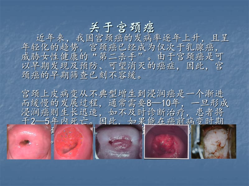 HPV病毒介绍及检测意义ppt课件_第3页