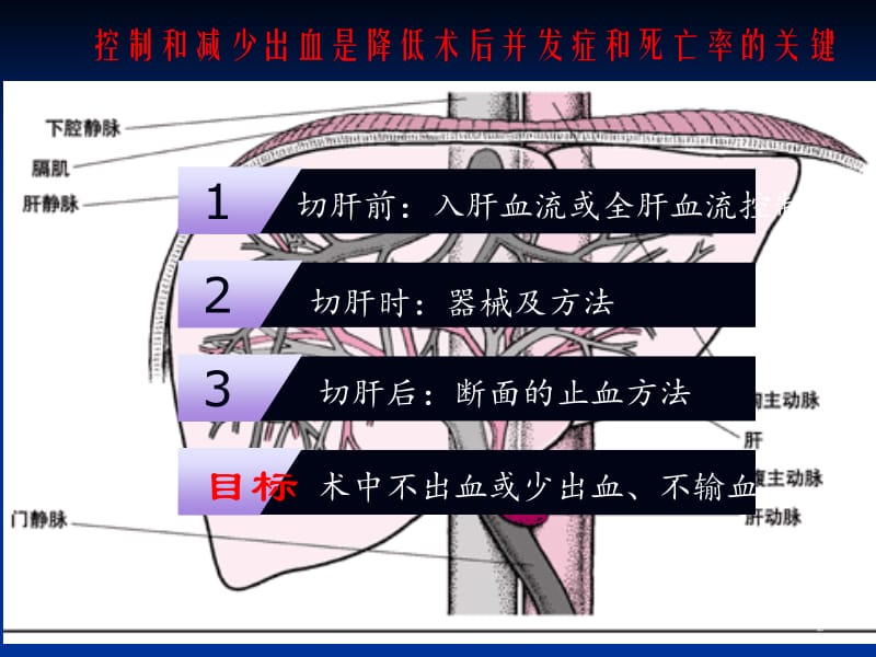 肝脏手术止血技巧ppt课件_第2页