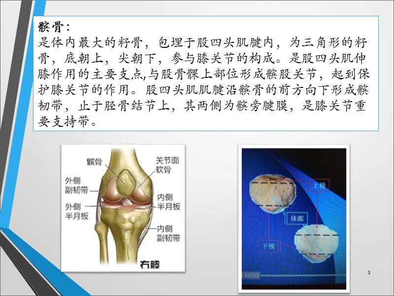 髌骨骨折原因及护理ppt演示课件_第3页