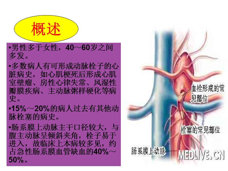 肠系膜动脉血栓讲课ppt医学课件_第3页