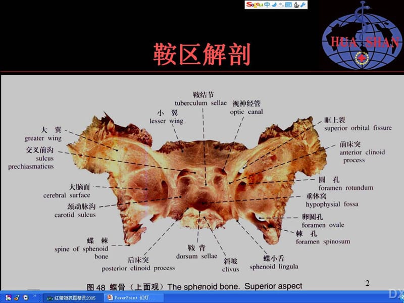 鞍区病变影像诊断ppt演示课件_第2页