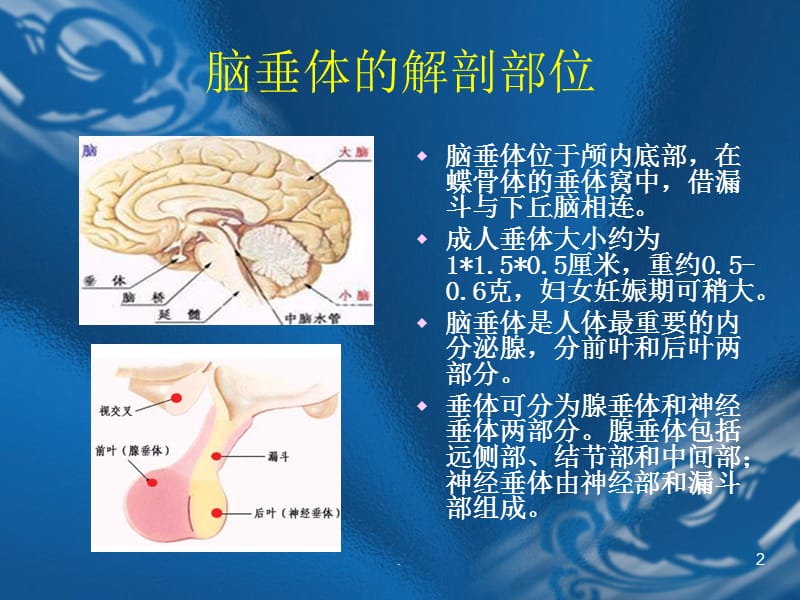 垂体瘤的围手术期护理ppt医学课件_第2页