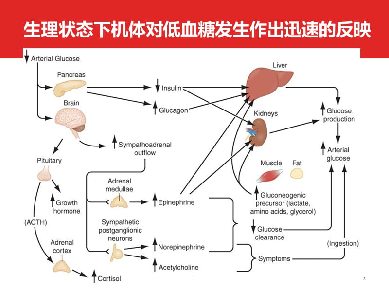 低血糖症诊治ppt医学课件_第3页