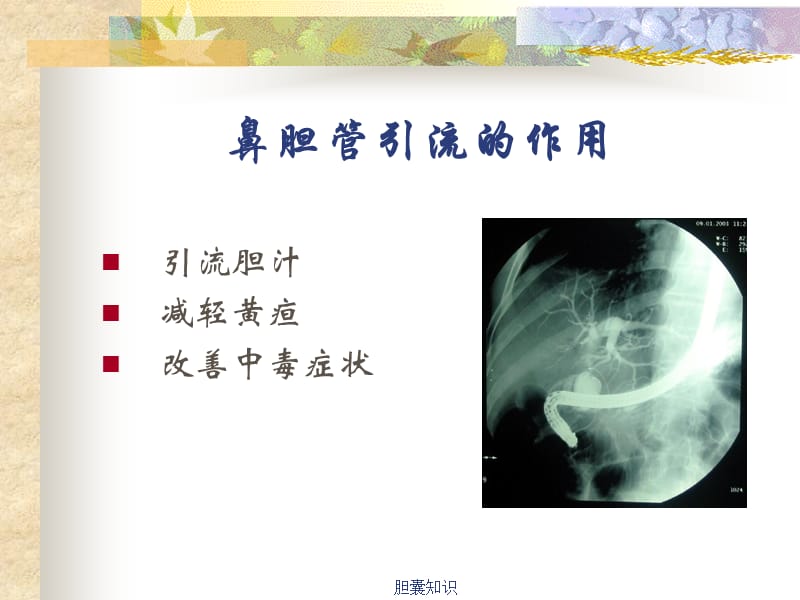 【胆】鼻胆管引流术护理_第2页