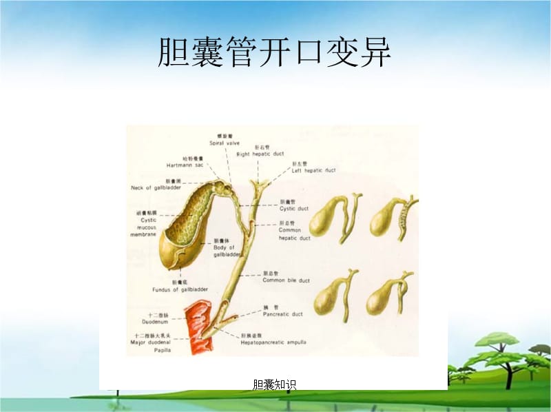 【胆】胆囊结石及其防治PPT课件_第3页