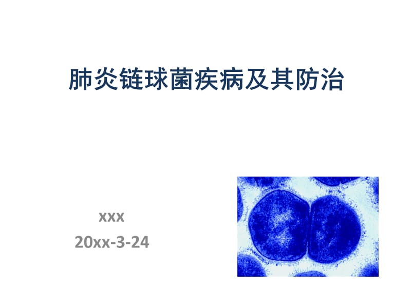 【肺炎PPT】肺炎链球菌研究现况及血清分型_第1页