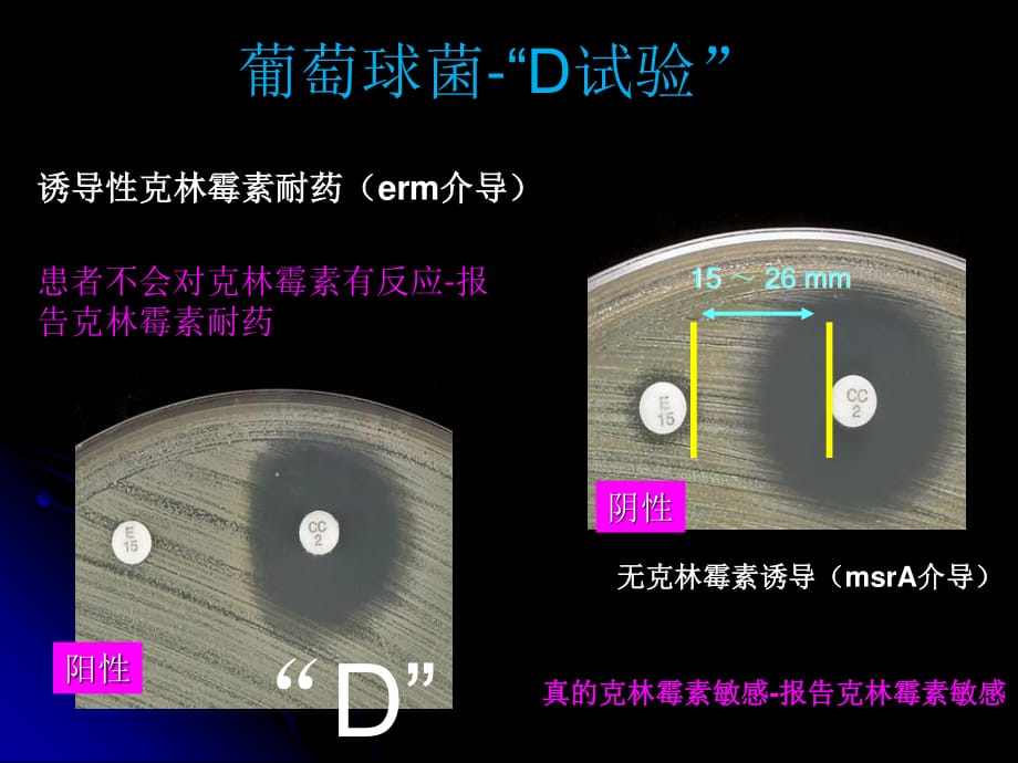 葡萄球菌-“D试验”.ppt_第1页