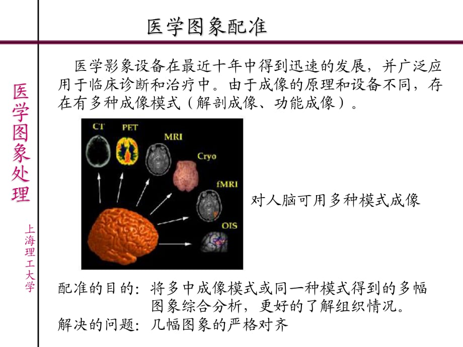 《醫(yī)學圖象處理》PPT課件.ppt_第1頁