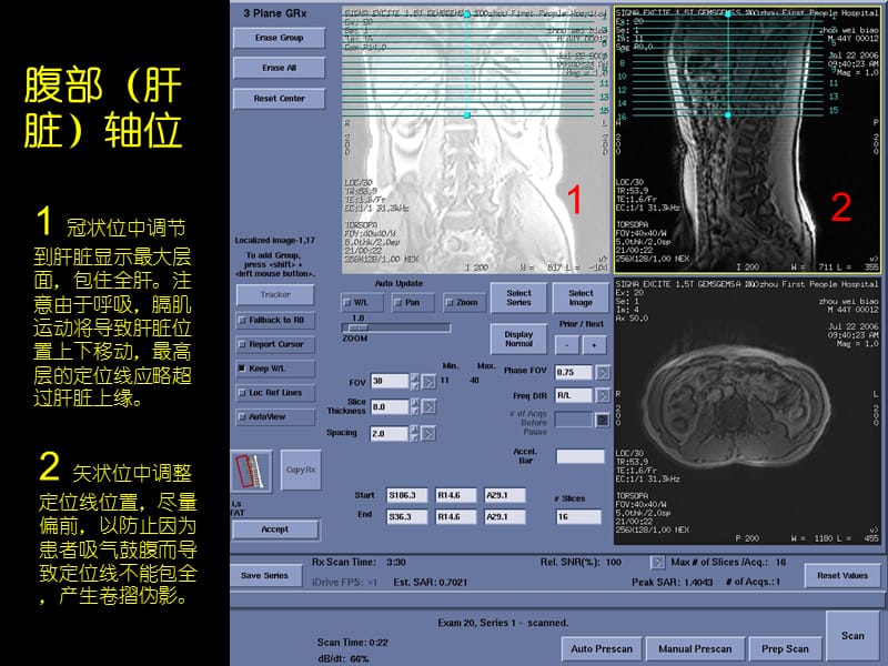 GE15T磁共振操作指南-定位线示例体部.ppt_第2页