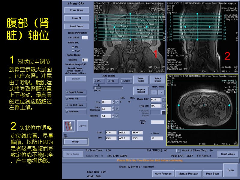 GE15T磁共振操作指南-定位线示例体部.ppt_第3页