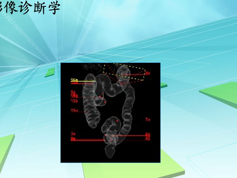 《肿瘤影像诊断学》PPT课件.ppt_第1页