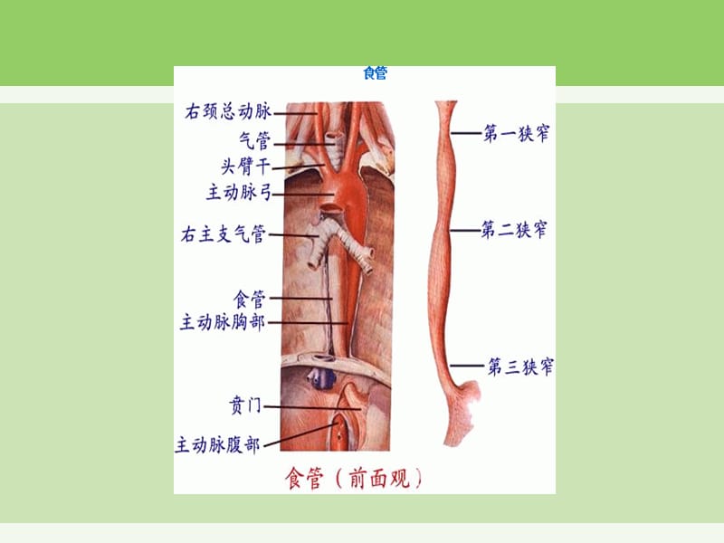 《食道癌护理查房》PPT课件.ppt_第3页