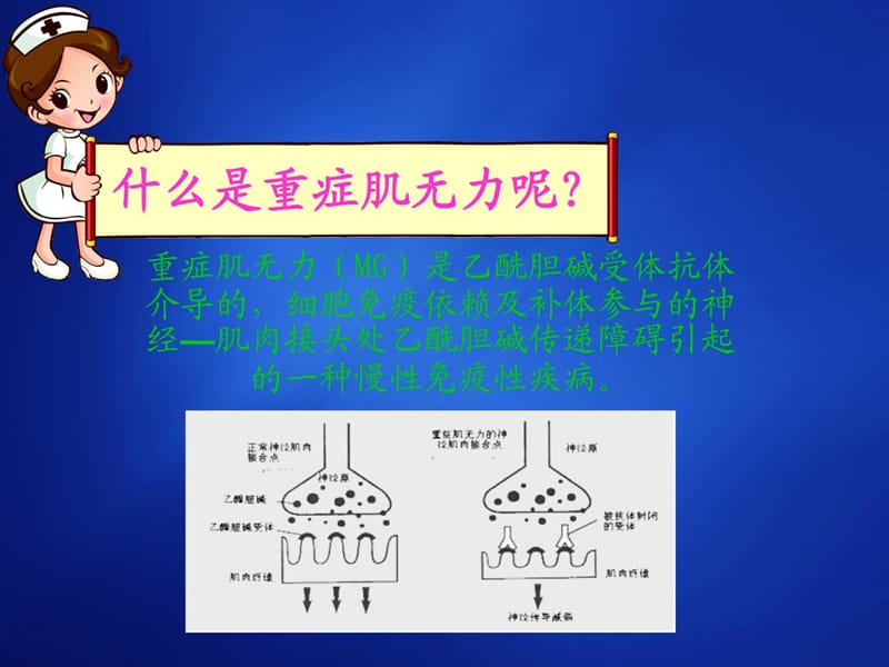 重症肌有力患者的护理.ppt_第2页