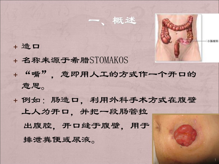 造口并发症的处理ppt课件.ppt_第1页