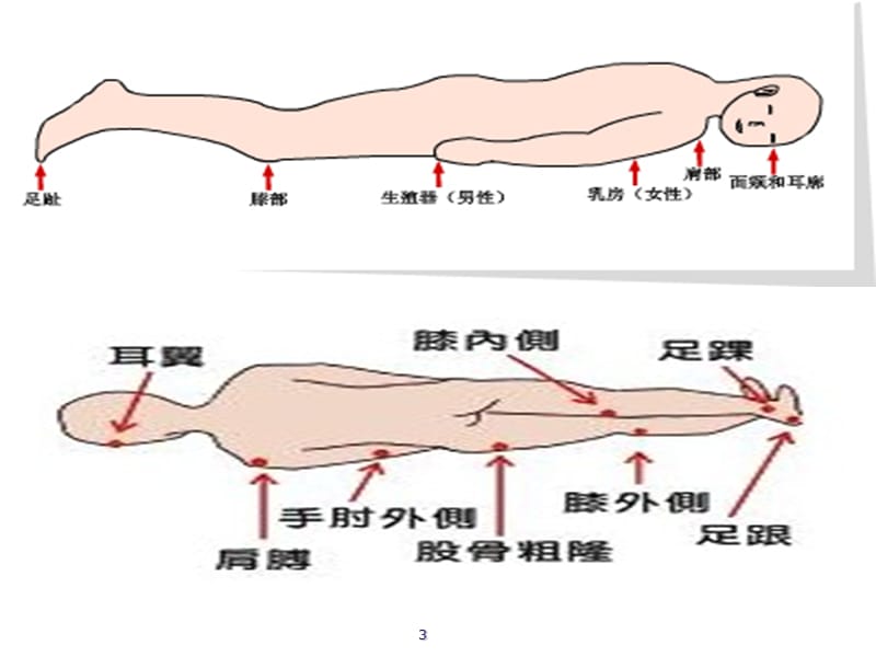 压疮湿性愈合理论ppt课件_第3页