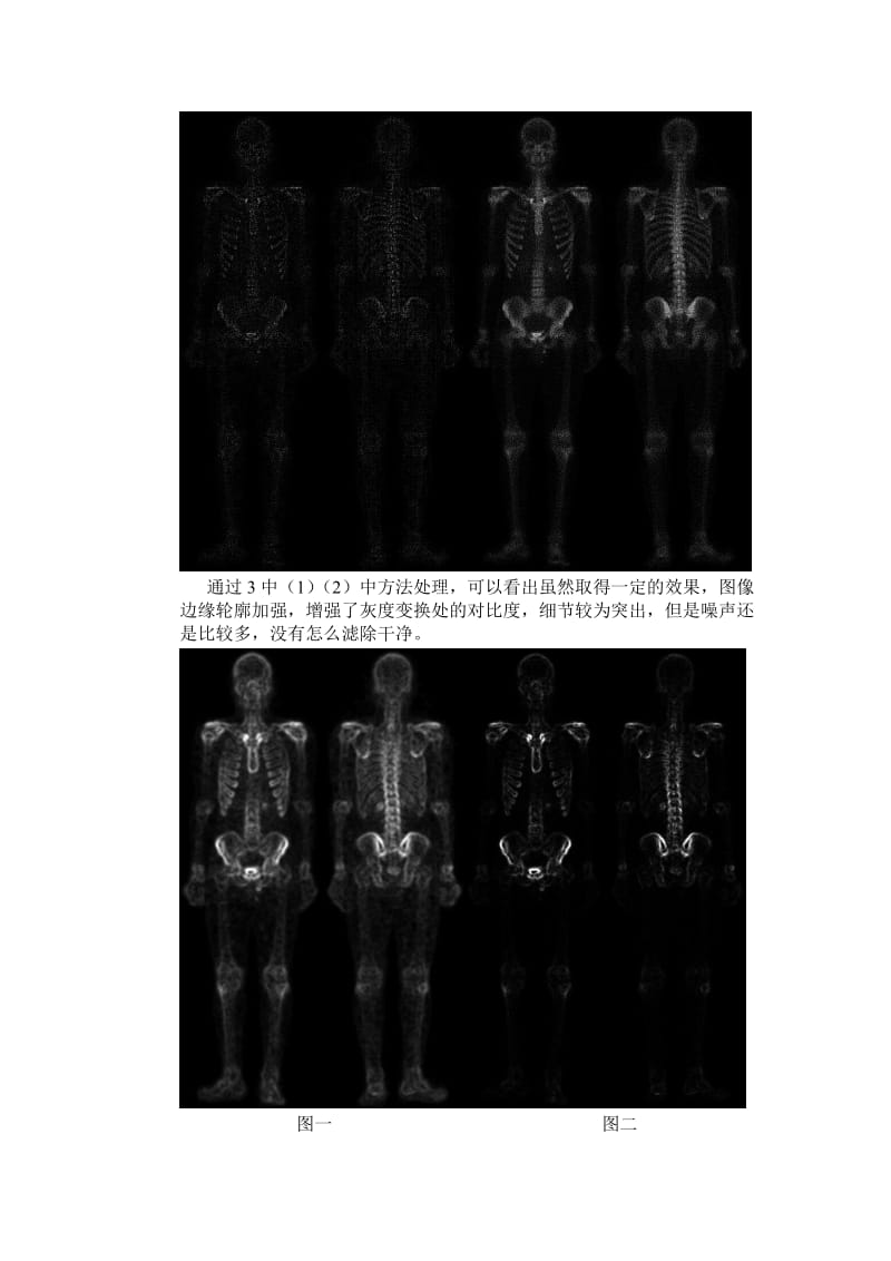 图像锐化处理实验报告.doc_第3页