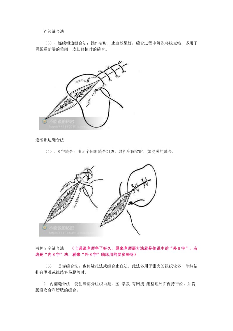 外科缝合的基本方法.doc_第3页