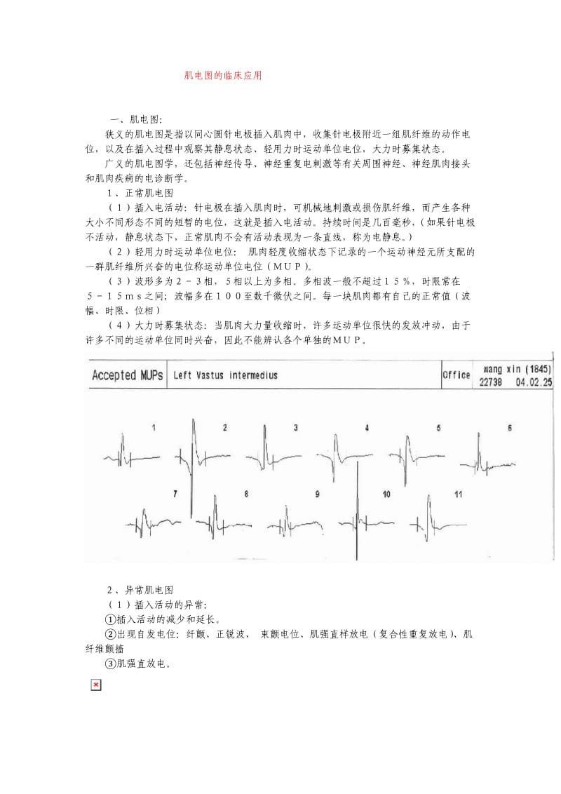 肌电图的临床应用.doc_第1页