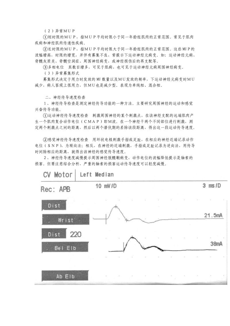 肌电图的临床应用.doc_第2页