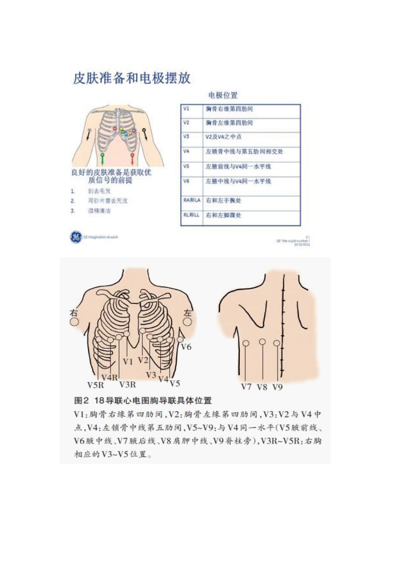 心电图操作要求及注意事项.doc_第2页