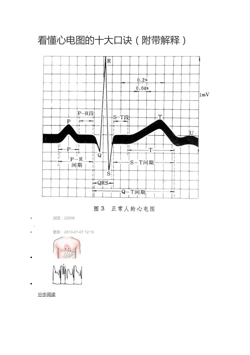 看懂心电图的十大口诀(附带解释).doc_第1页