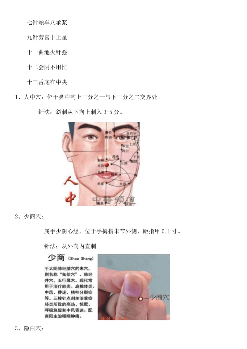 鬼门十三针图解.doc_第3页