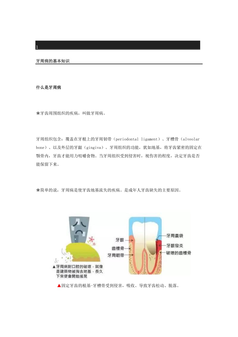 详解牙周病治疗的过程.doc_第1页