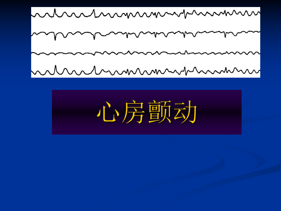 心房顫動.ppt_第1頁