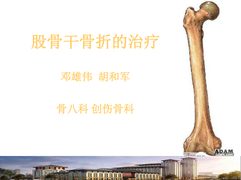 股骨干骨折骨折课件.ppt_第1页