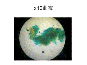 显微镜下霉菌(黑曲霉、根霉、青霉)形态观察图片