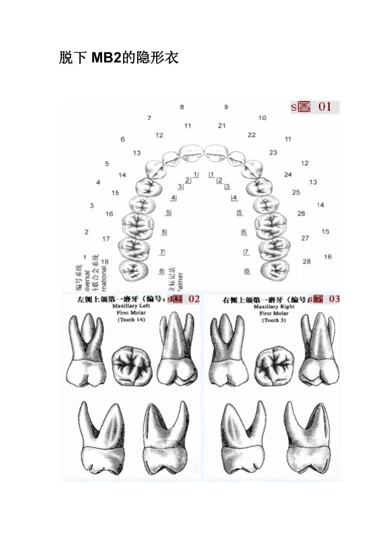 【口腔医学总结】脱下MB2的隐形衣（图片）_第1页