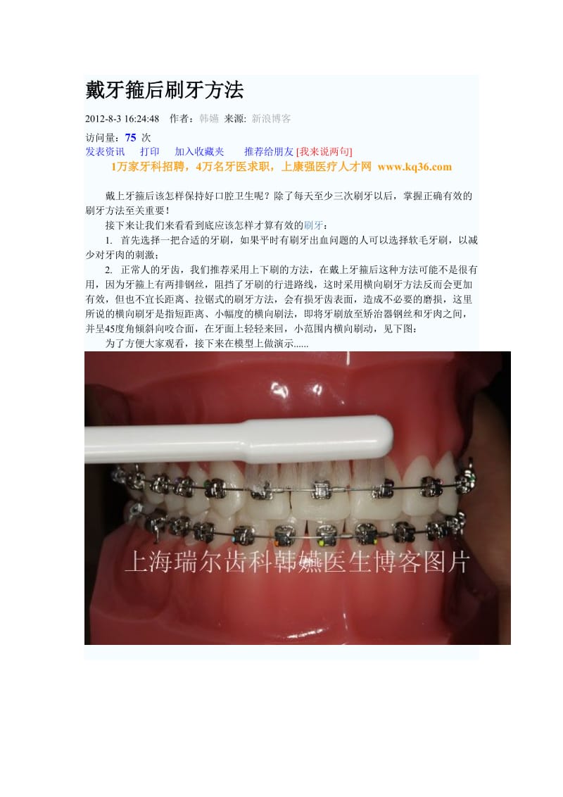 【口腔医学总结】戴牙箍后刷牙方法_第1页