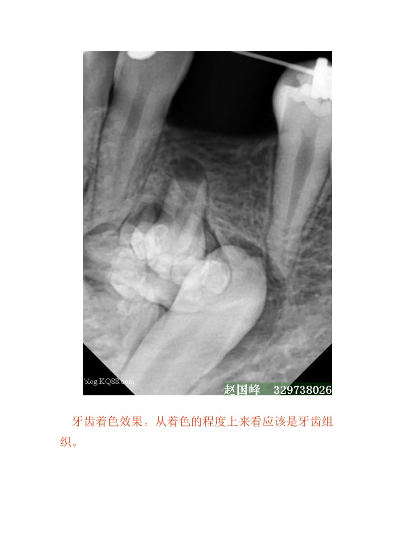 【口腔医学总结】千奇百怪的牙_第2页