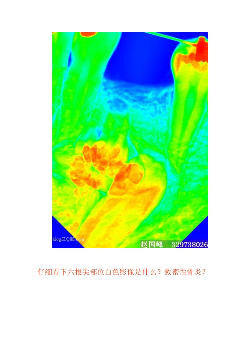 【口腔医学总结】千奇百怪的牙_第3页