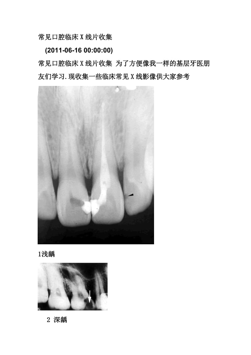 【口腔医学总结】常见口腔临床X线片收集_第1页