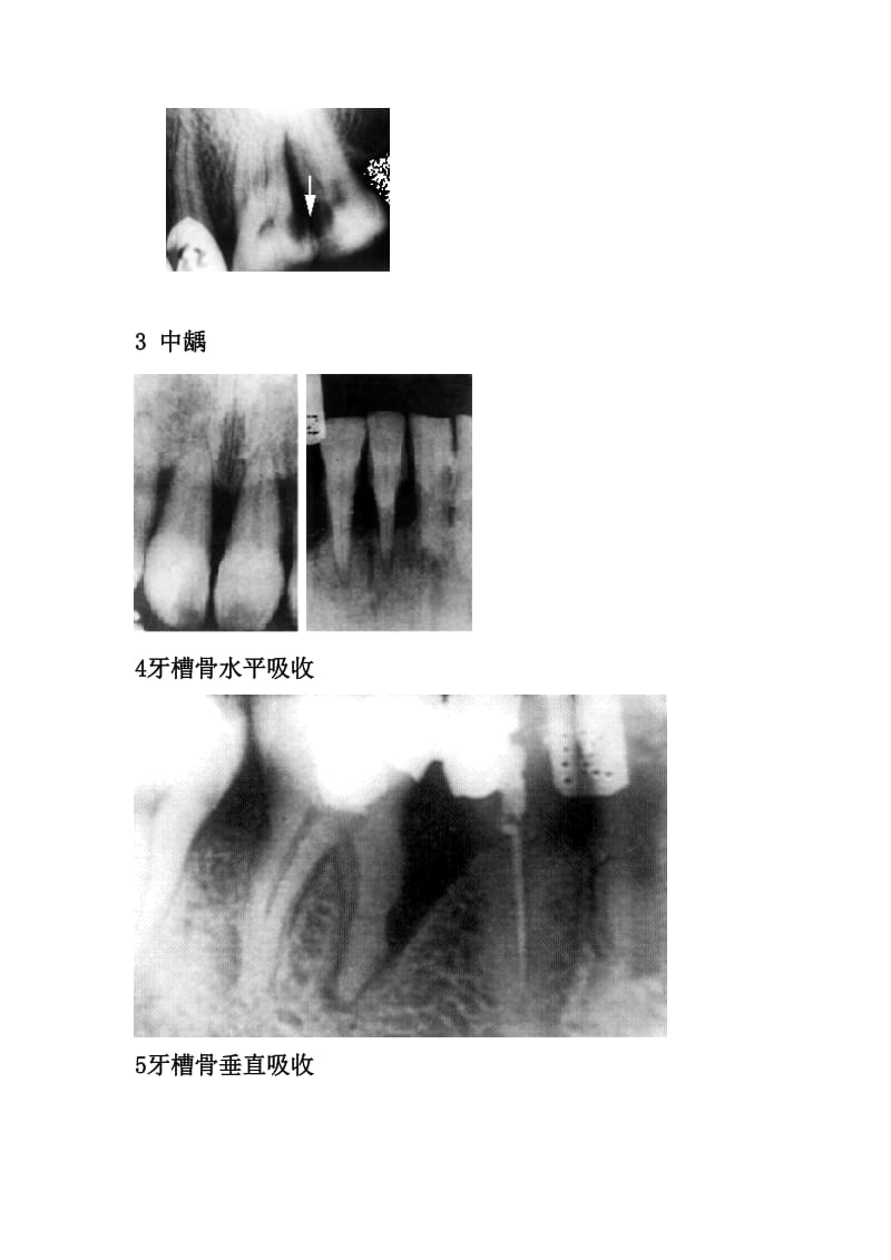 【口腔医学总结】常见口腔临床X线片收集_第2页