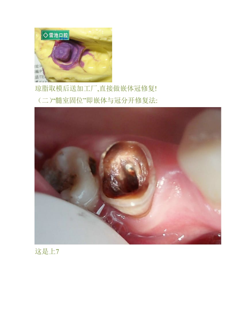 【口腔医学总结】支抗临床经验荟萃(五)_第2页