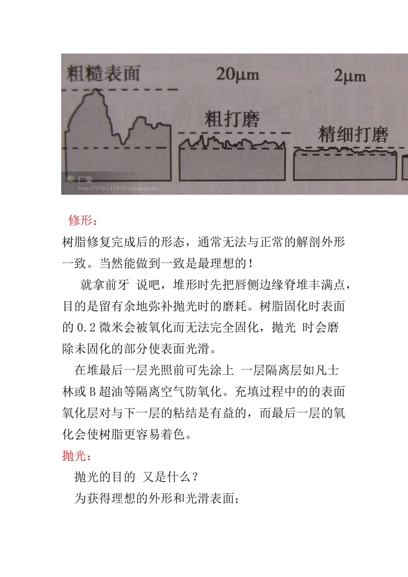 【口腔医学总结】树脂的修形抛光——广泉_第2页