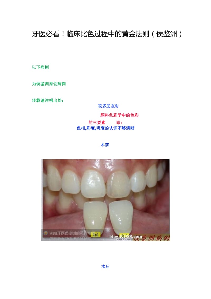 【口腔医学总结】牙医必看！临床比色过程中的黄金法则（侯鉴洲）_第1页