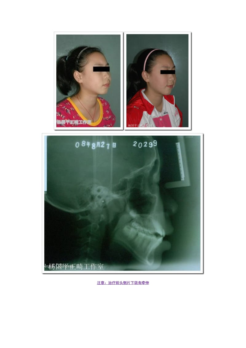 【口腔医学总结】警惕正畸治疗中的陷阱（二）_第3页